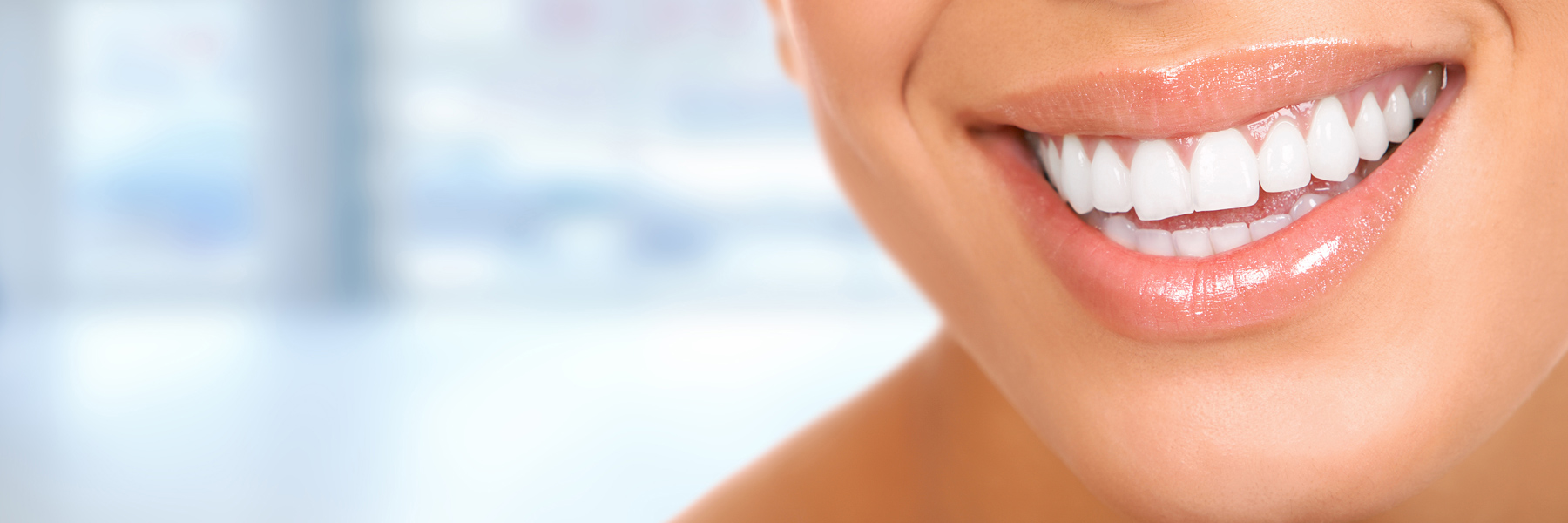 apex dental